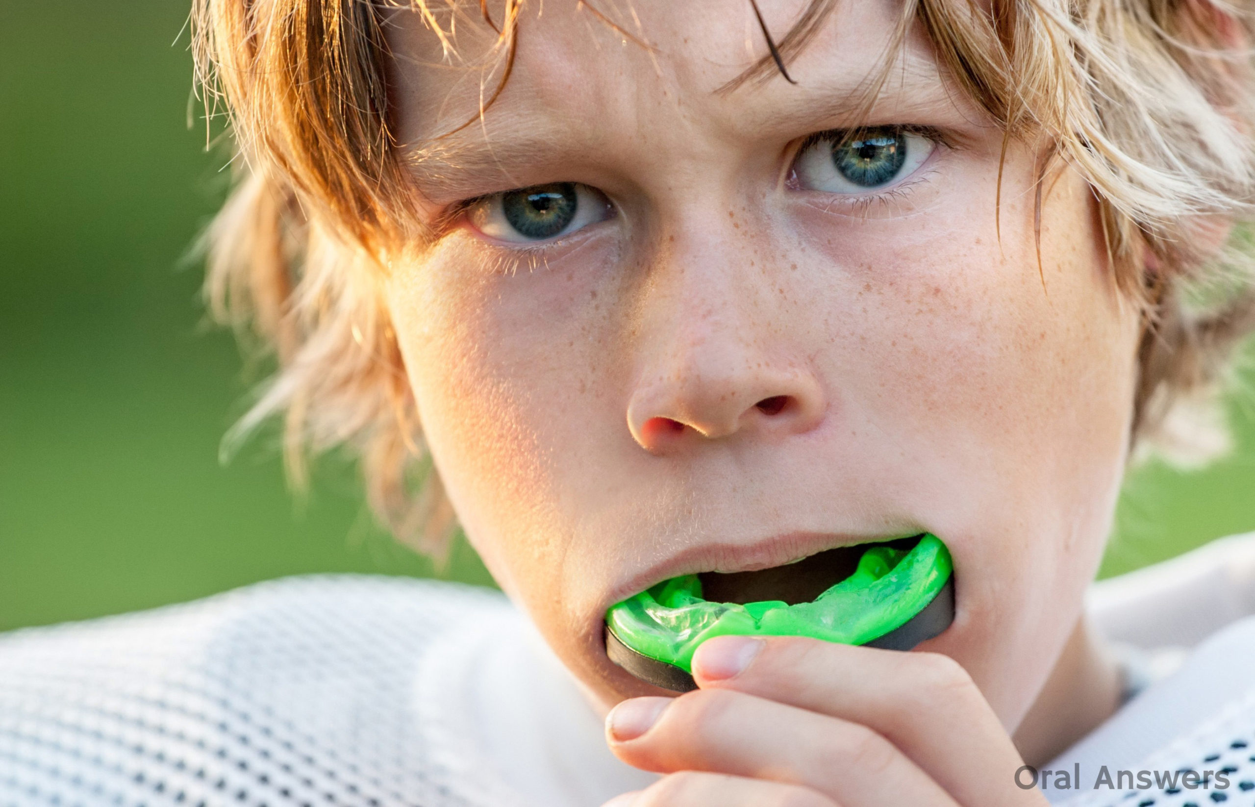 Young male wearing mouthguard