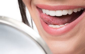 woman smiling - close up of teeth